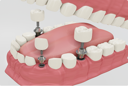 Digital Transformation