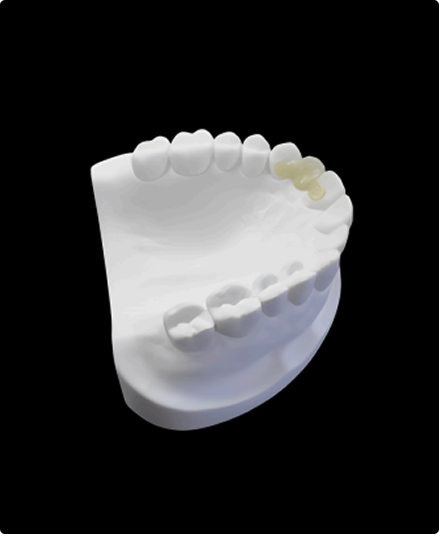 Maryland Bonded Bridges