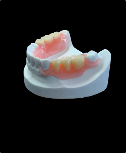 Partial Dentures